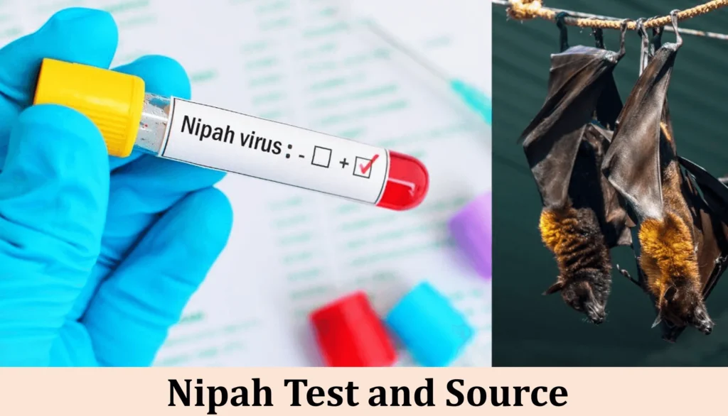 Nipah Virus: Causes, Symptoms, and How to Stay Safe 3 Nipah Test