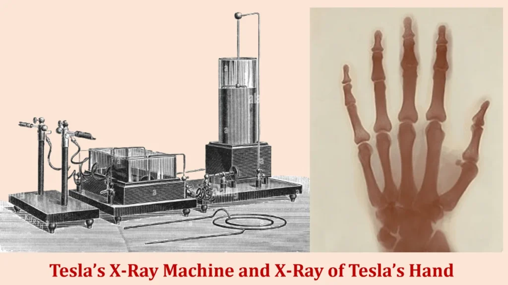 Nikola Tesla: The Genius Brain Whose Ideas Still Light Up the World 7 Tesla's X-Ray Machine